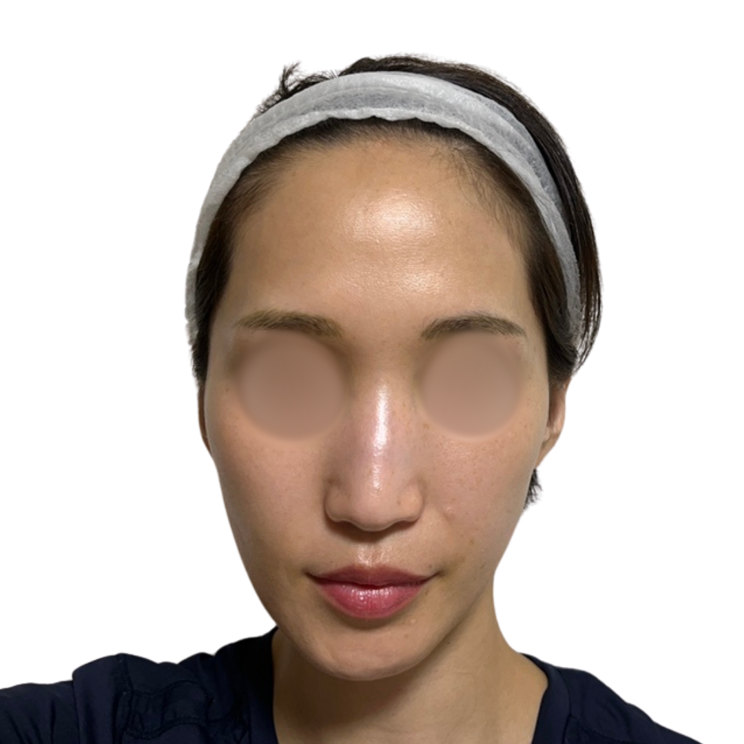 パーティーリフト（スマスアップネオ）